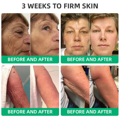 💖🍂Flysmus™ Wrinkle Removel Cream,Address Crepe & Sagging(🔥74% Off for a Limited Time!)