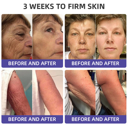 🐝🪻Flysmus™ Neck care stick Firming Cream,Address Crepe & Sagging(🔥74% Off for a Limited Time!)