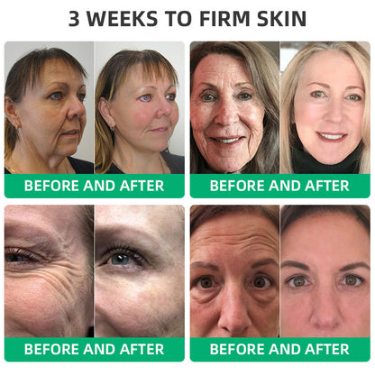 💖🍂Flysmus™ Wrinkle Removel Cream,Address Crepe & Sagging(🔥74% Off for a Limited Time!)