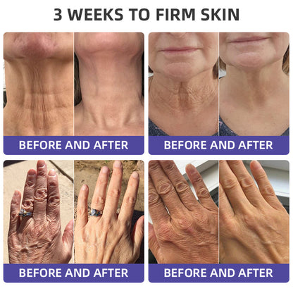 🐝🪻Flysmus™ Neck care stick Firming Cream,Address Crepe & Sagging(🔥74% Off for a Limited Time!)
