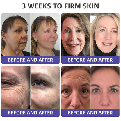 🐝🪻Flysmus™ Neck care stick Firming Cream,Address Crepe & Sagging(🔥74% Off for a Limited Time!)