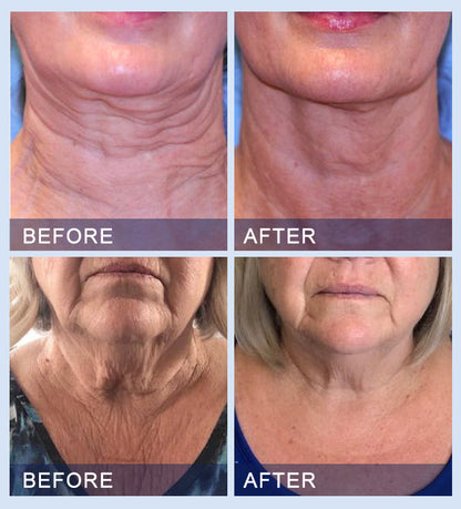 💧🎈Furzero™ All-in-One Lifting & Firming Serum Address Crepe & Sagging(🔥74% Off for a Limited Time!)