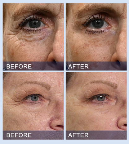 💧🎈Furzero™ All-in-One Lifting & Firming Serum Address Crepe & Sagging(🔥74% Off for a Limited Time!)