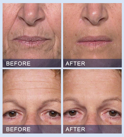 💧🎈Furzero™ All-in-One Lifting & Firming Serum Address Crepe & Sagging(🔥74% Off for a Limited Time!)